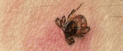 Клещевой боррелиоз новая болезнь века